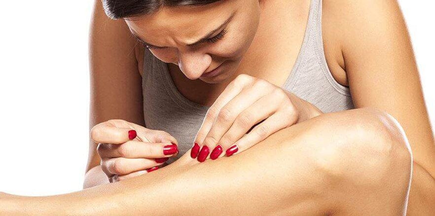 What Are Ingrown Hairs? We Have the Solution!