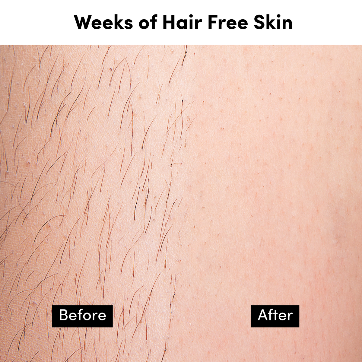 Legs & Body Organic Sugar Wax